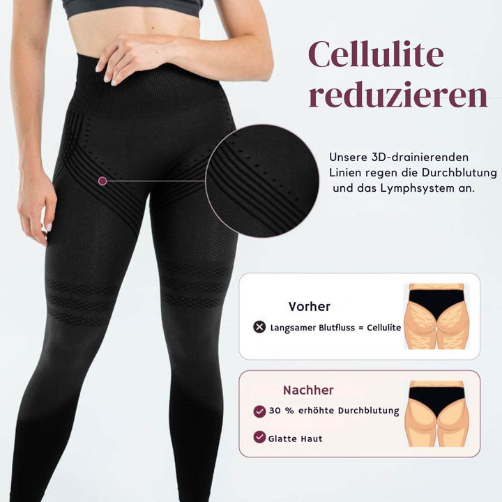 SlimFit™ – Anti-Cellulite-Leggings